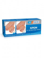 Крем До и после от пигментных пятен 50 мл